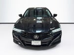 2025 Acura TLX Technology Package