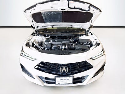 2025 Acura TLX Technology Package