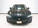 2025 Acura TLX Technology Package