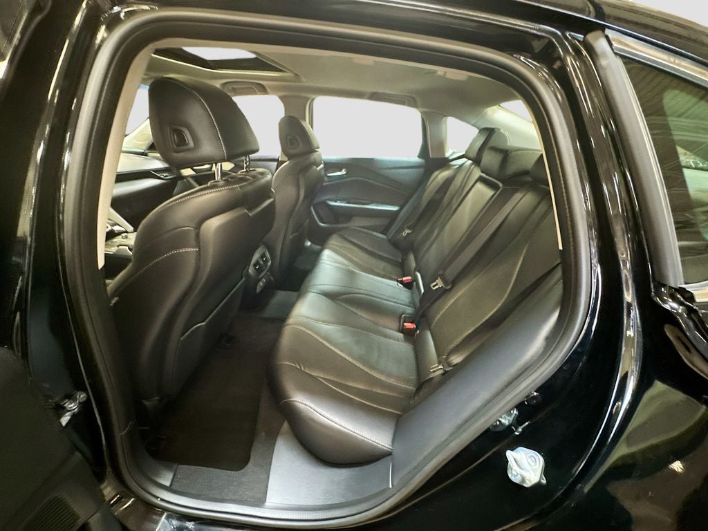 2025 Acura TLX Technology Package
