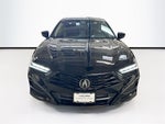 2025 Acura TLX Technology Package