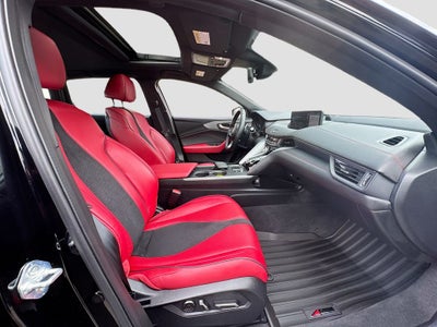 2025 Acura TLX A-Spec Package SH-AWD
