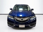 2017 Acura RDX Technology Package
