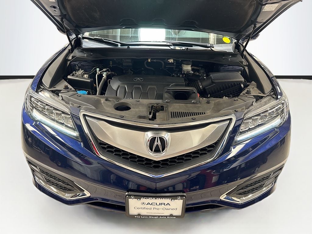 2017 Acura RDX Technology Package